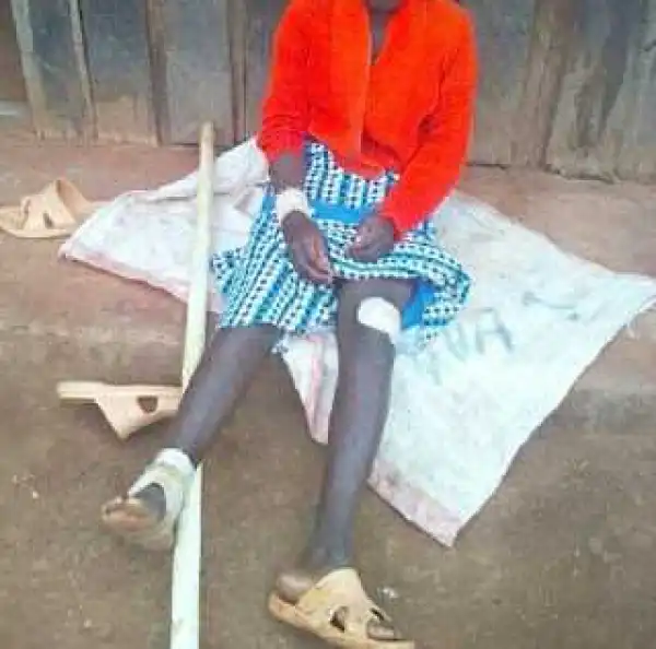 Photo: Man slashes teenage daughter, beats her up for talking to a boy